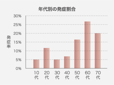 網膜剥離発症のピークは20代と50代以降です