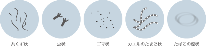 糸くず状 虫状 ゴマ状 カエルのたまご状 たばこの煙状