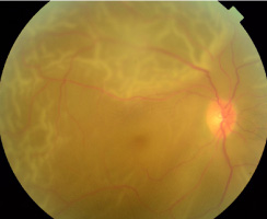 放っておくと徐々に症状が進行してしまいます